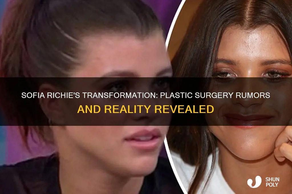 does sofia richie have plastic surgery