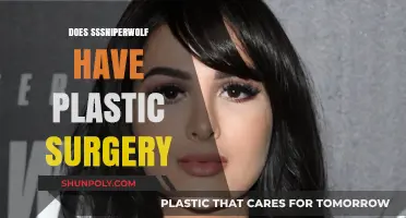 SSSniperwolf Plastic Surgery: Fact-Checking Her Transformation Rumors