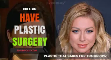 Stassi Schroeder's Transformation: Plastic Surgery Speculations and Truths