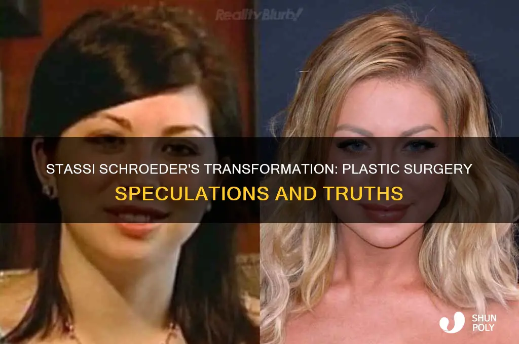 does stassi have plastic surgery