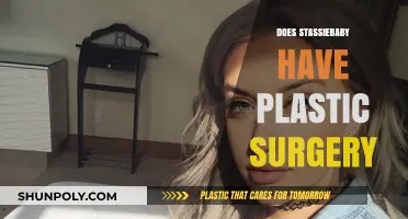 Stassiebaby Plastic Surgery: Fact-Checking the Rumors and Speculations