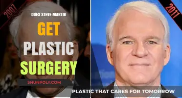 Steve Martin's Transformation: Plastic Surgery Speculations and Truths