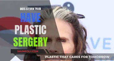 The Transformation of Steven Tyler: Plastic Surgery Speculation