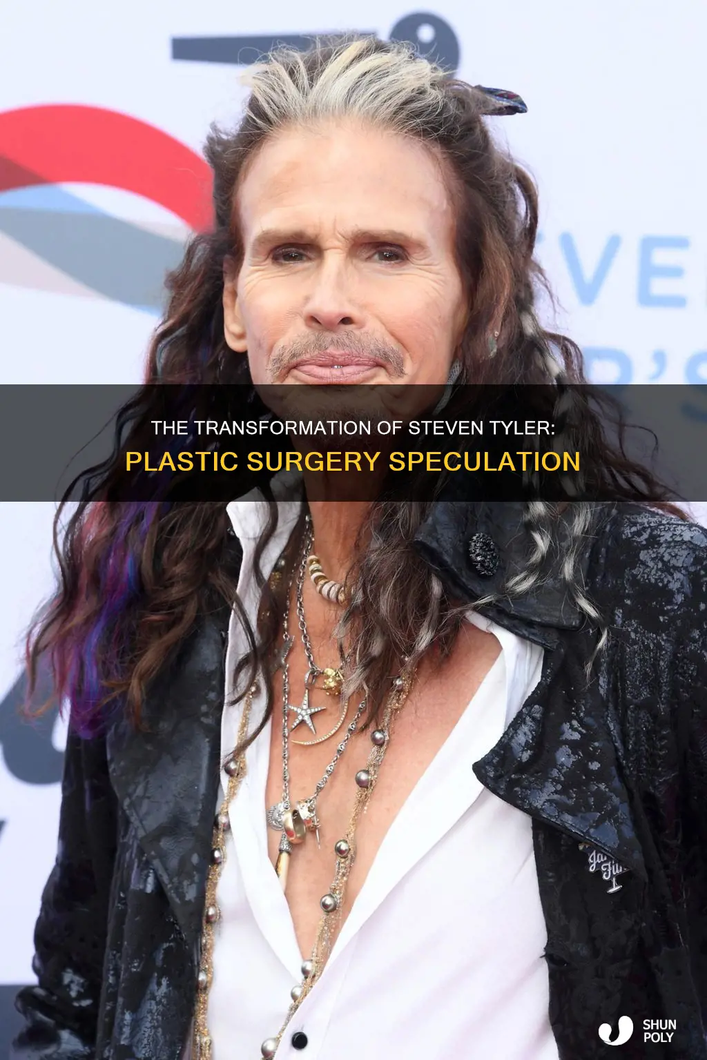 does steven tyler have plastic sergery
