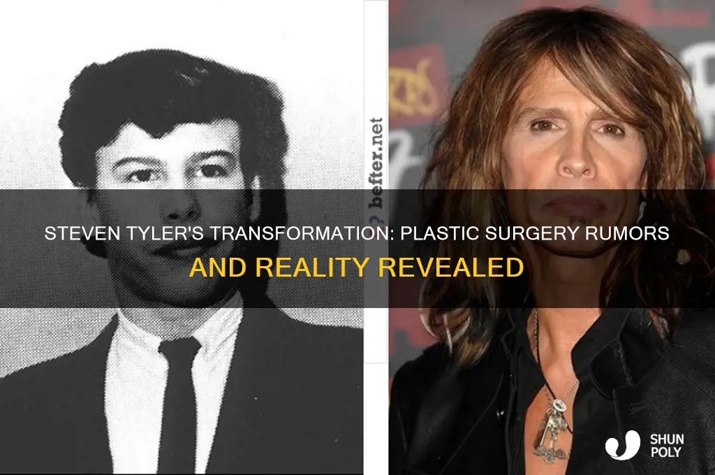 does steven tyler have plastic surgery