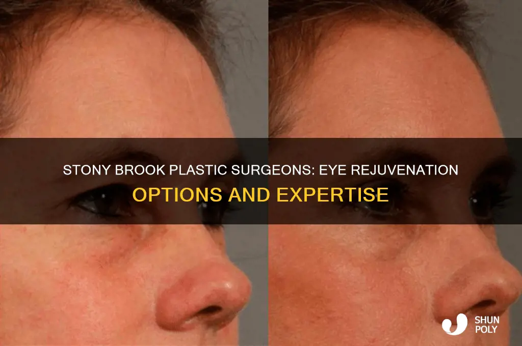 does stony brook have plastic surgeons for eye rejuvenation
