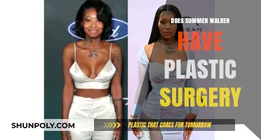 Summer Walker Plastic Surgery: Fact-Checking the Rumors and Speculations