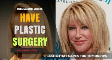 Suzanne Somers Plastic Surgery: Fact-Checking the Rumors and Speculations