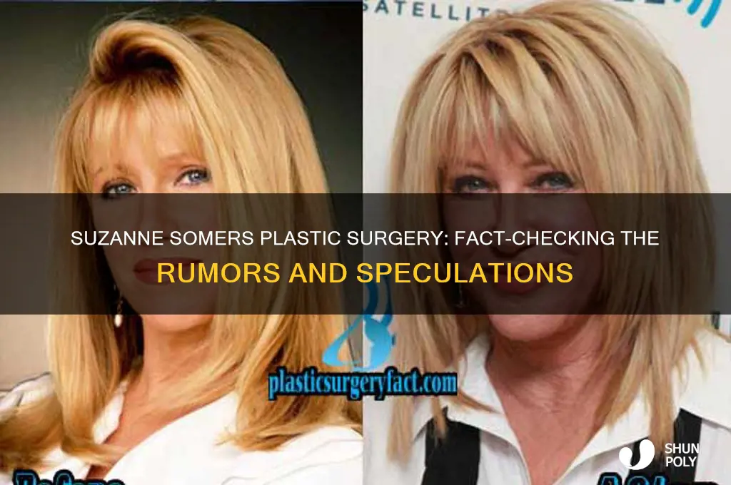 does suzanne somers have plastic surgery