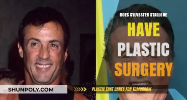 Sylvester Stallone's Transformation: Plastic Surgery Rumors Explored