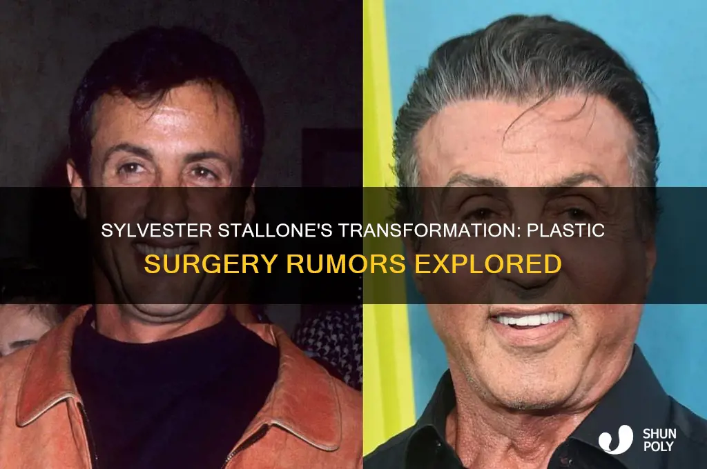 does sylvester stallone have plastic surgery