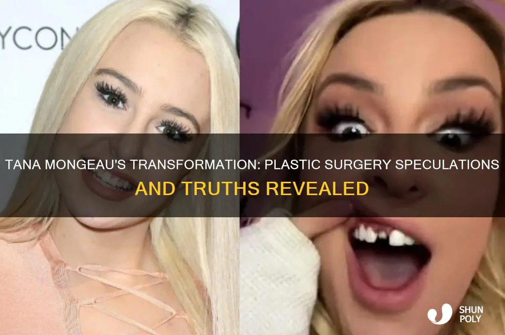 does tana mongeau have plastic surgery