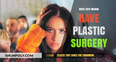 Tate McRae Plastic Surgery: Fact-Checking the Rumors and Speculations