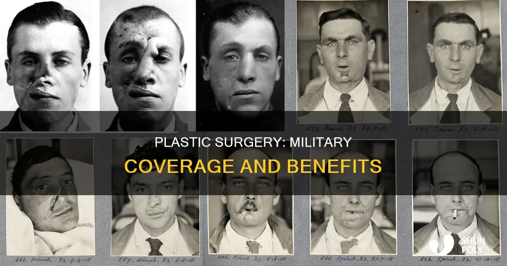 does the military cover plastic surgury