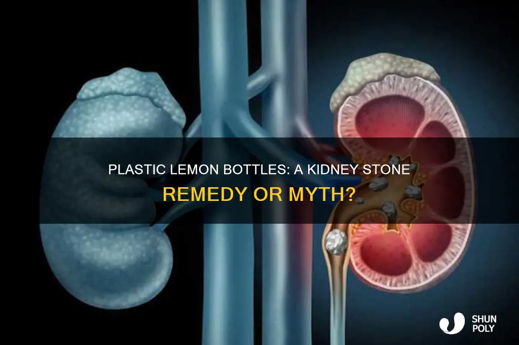 does the plastic lemon bottle help with kidney stones