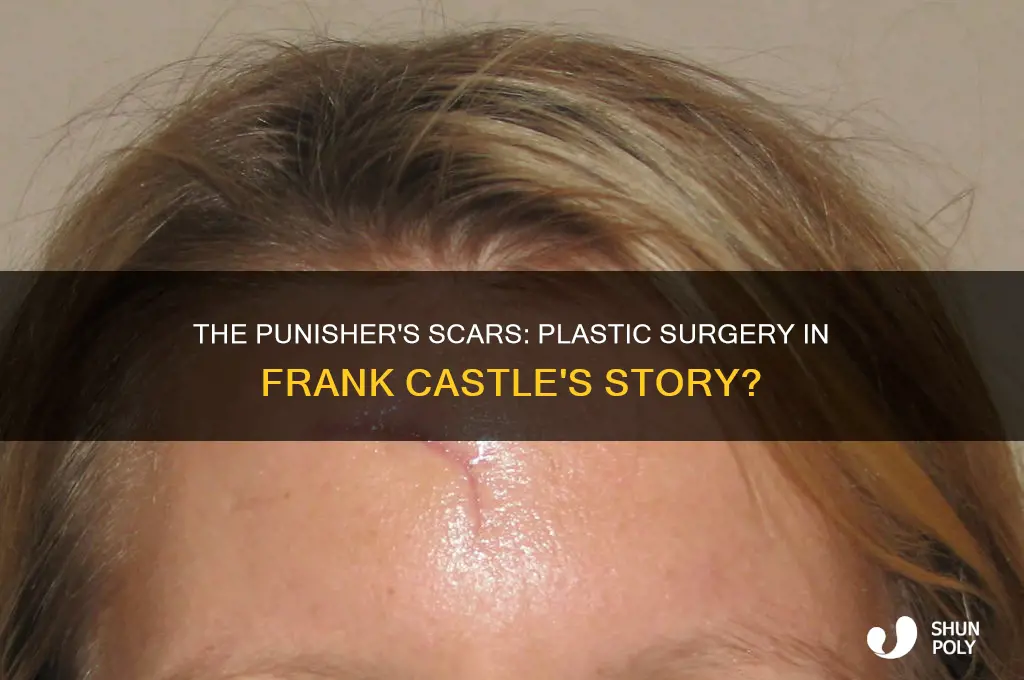 does the punisher ever get plastic surgery