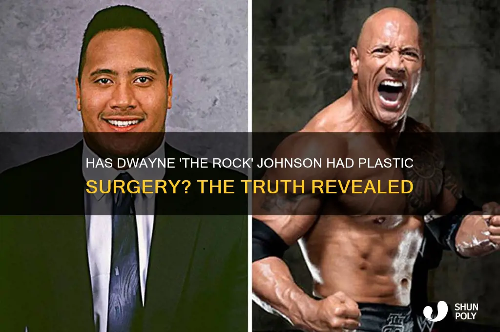 does the rock have plastic surgery
