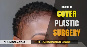Does VA Cover Plastic Surgery? Eligibility and Benefits Explained