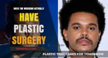 Weekend's Transformation: Plastic Surgery Rumors and the Truth Behind Them