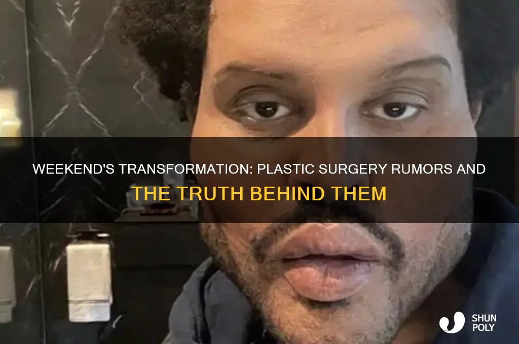 does the weekend actually have plastic surgery