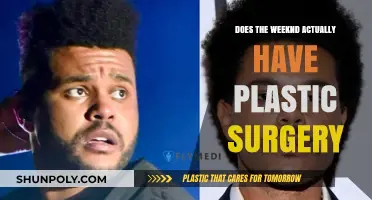 The Weeknd's Transformation: Plastic Surgery Rumors Explored and Debunked