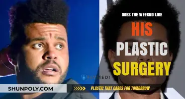 The Weeknd's Plastic Surgery: Fan Reactions and Personal Choices