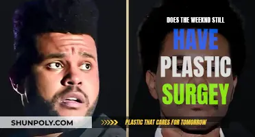 The Weeknd's Plastic Surgery: What's Real and What's Not?