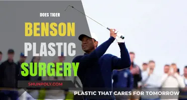 Tiger Benson Plastic Surgery: Fact-Checking Rumors and Real Transformations