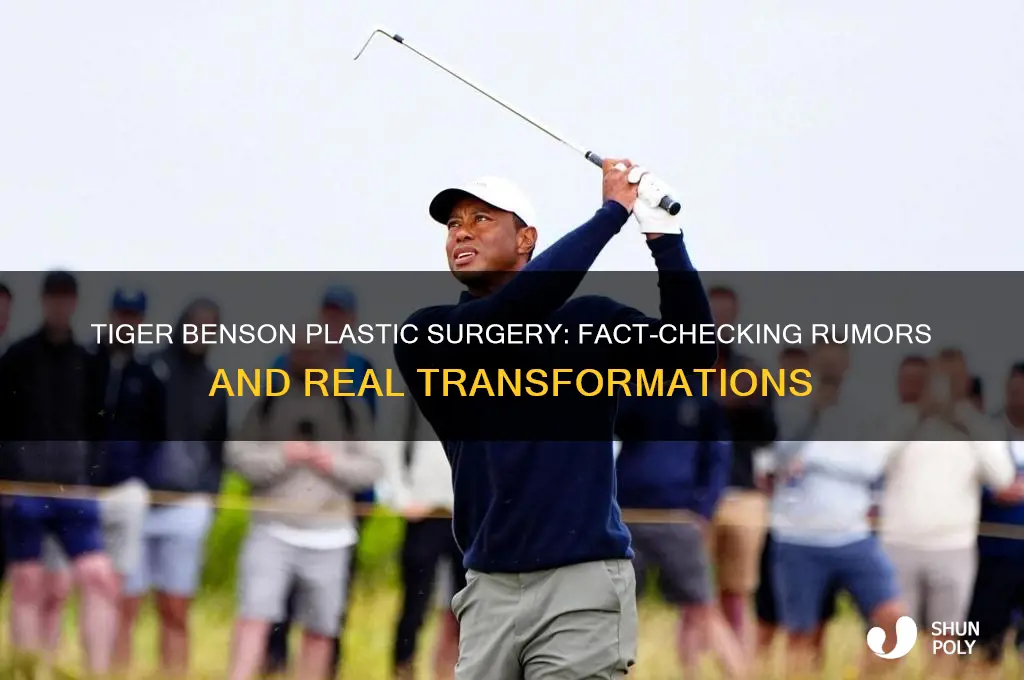does tiger benson plastic surgery