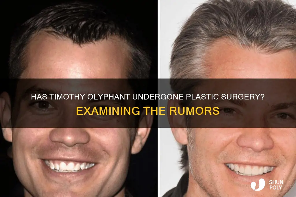 does timothy olyphant have plastic surgery