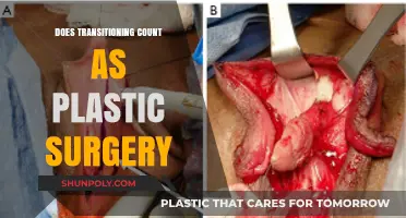Is Gender Transition Surgery Considered Plastic Surgery? Exploring the Debate