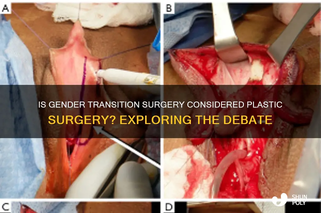 does transitioning count as plastic surgery