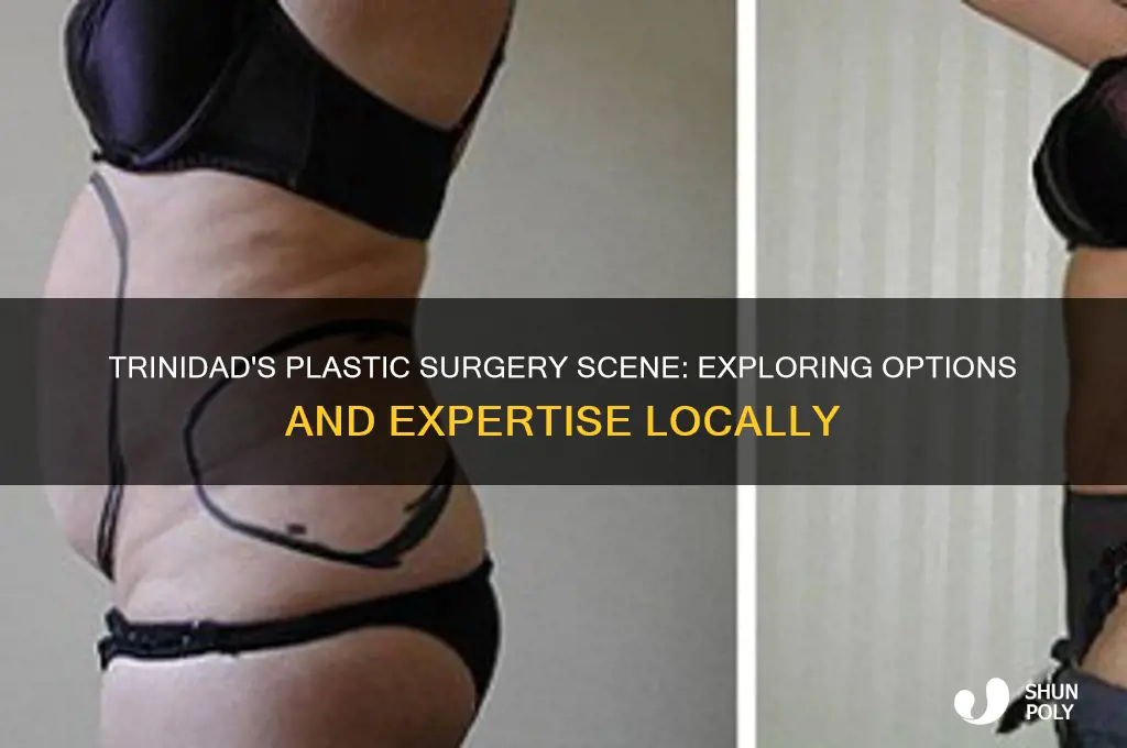 does trinidad have plastic surgeon