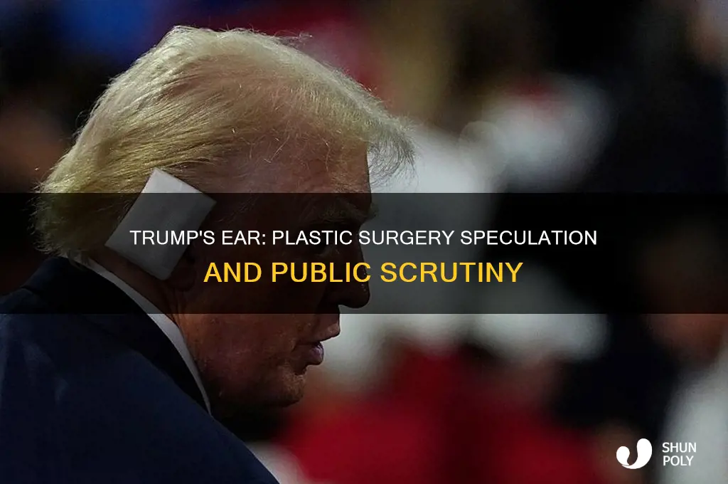 does trump need plastic surgery on his ear