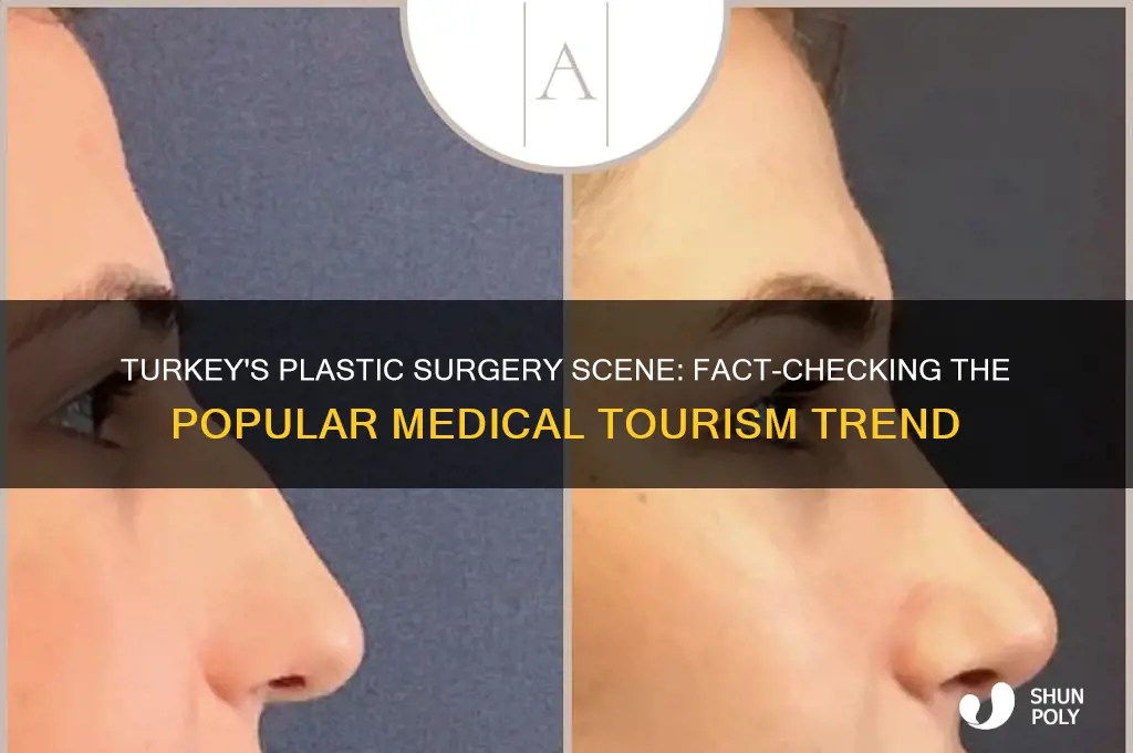 does turkey perform plastic surgery