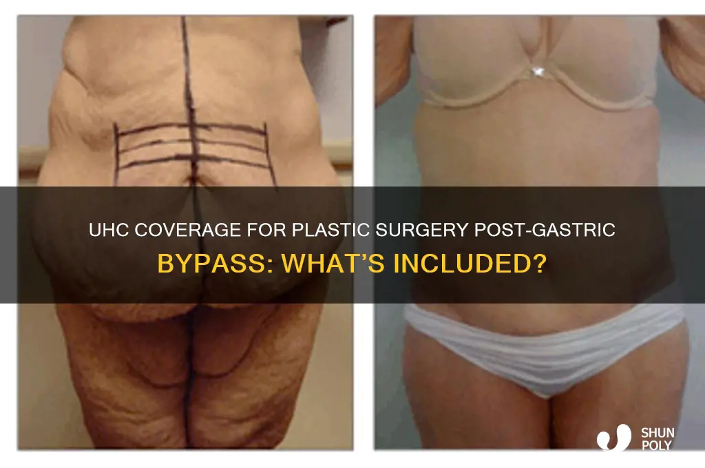 does uhc cover plastic surgery after gastric bypass