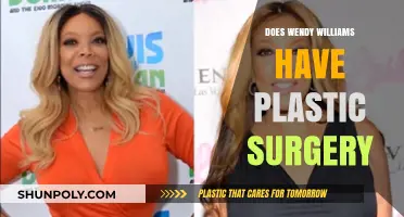 Wendy Williams Plastic Surgery: Fact-Checking Her Transformation Rumors
