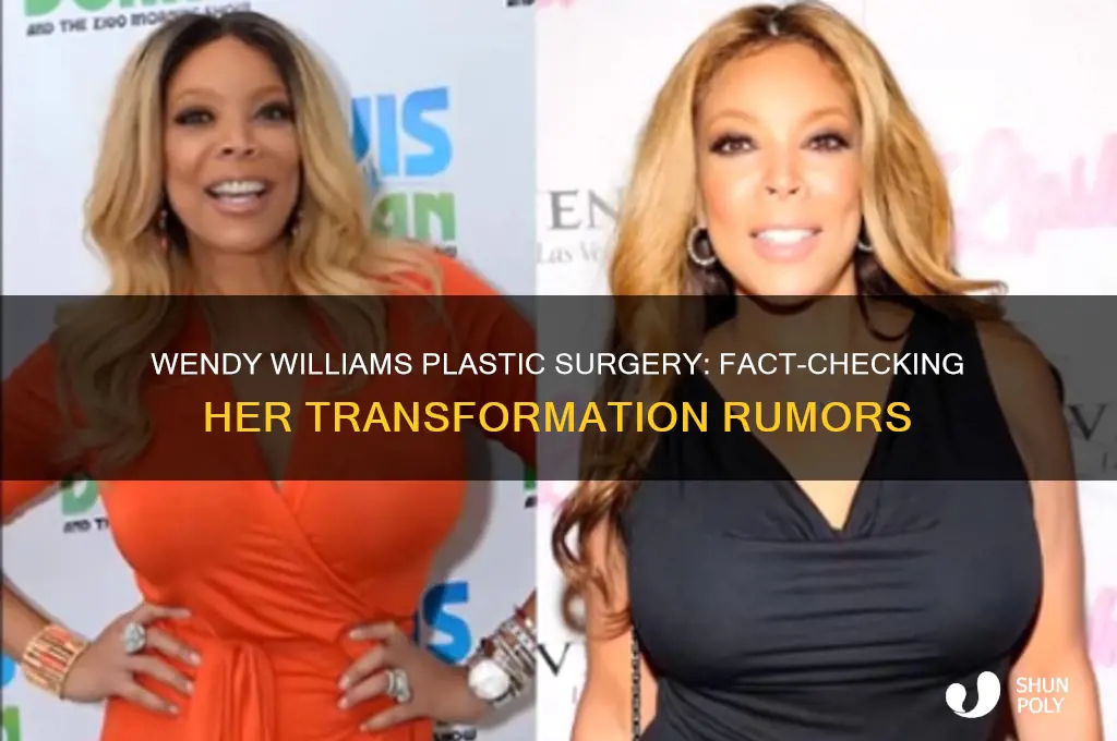 does wendy williams have plastic surgery