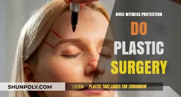 Does Witness Protection Include Plastic Surgery? Unveiling the Truth