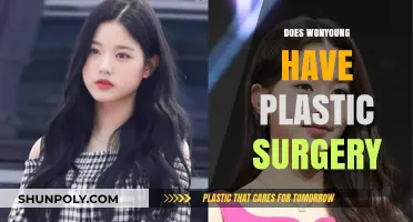Does Wonyoung Have Plastic Surgery? Uncovering the Truth Behind Her Look
