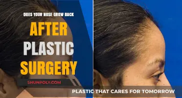 Nose Regrowth After Plastic Surgery: Fact or Fiction?