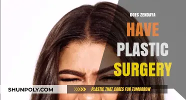 Zendaya's Transformation: Plastic Surgery Rumors and the Truth Behind Them