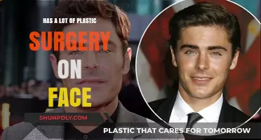 Transformed Faces: The Rise of Extensive Plastic Surgery Trends