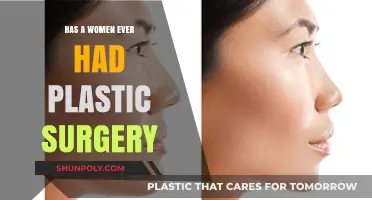 Have Women Ever Undergone Plastic Surgery? Exploring the Facts and Trends