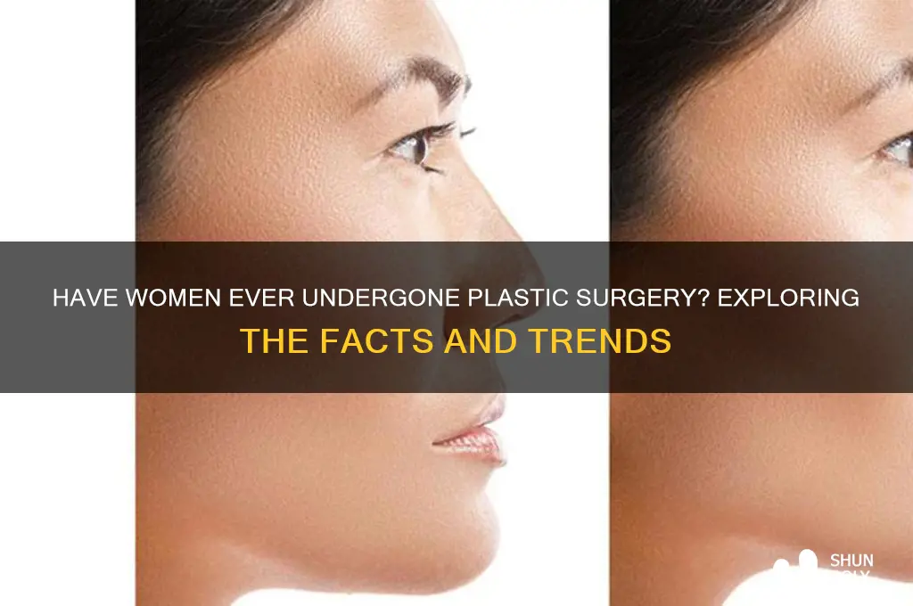 has a women ever had plastic surgery