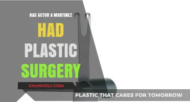 Has A Martinez Had Plastic Surgery? Uncovering the Truth