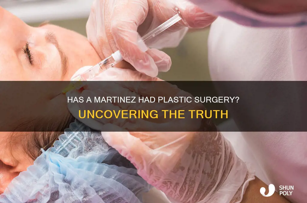 has actor a martinez had plastic surgery