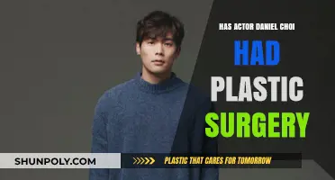 Daniel Choi's Transformation: Plastic Surgery Rumors Explored and Debunked
