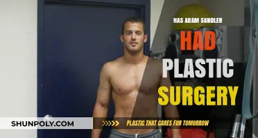 Adam Sandler's Transformation: Plastic Surgery Rumors Explored and Debunked