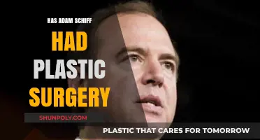 Adam Schiff Plastic Surgery: Fact-Checking the Rumors and Speculations